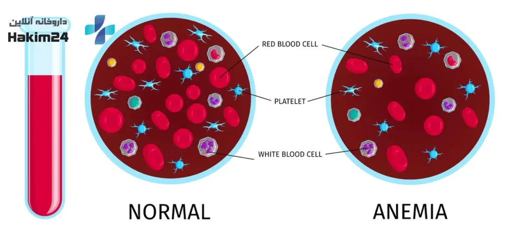 درمان کم خونی