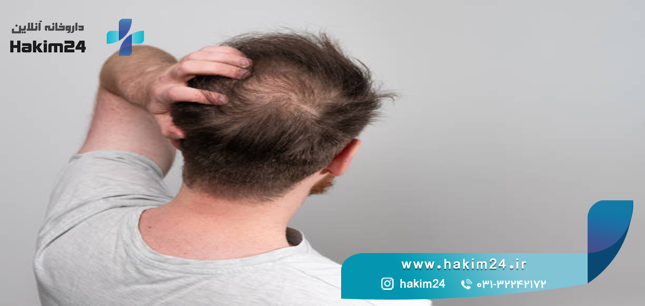 جلوگیری از ریزش مو