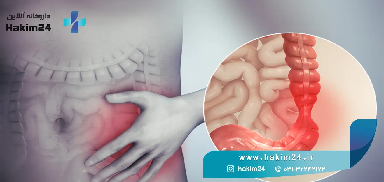 سندروم روده تحریک پذیر