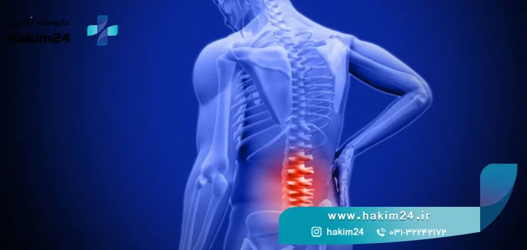 پیشگیری از کمردرد