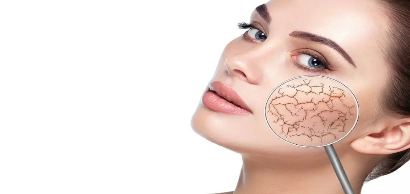 چگونه خشکی پوست را درمان کنیم؟ راهکارهای موثر مراقبت از پوست