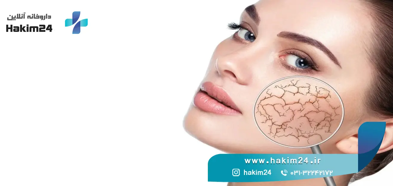 چگونه خشکی پوست را درمان کنیم؟