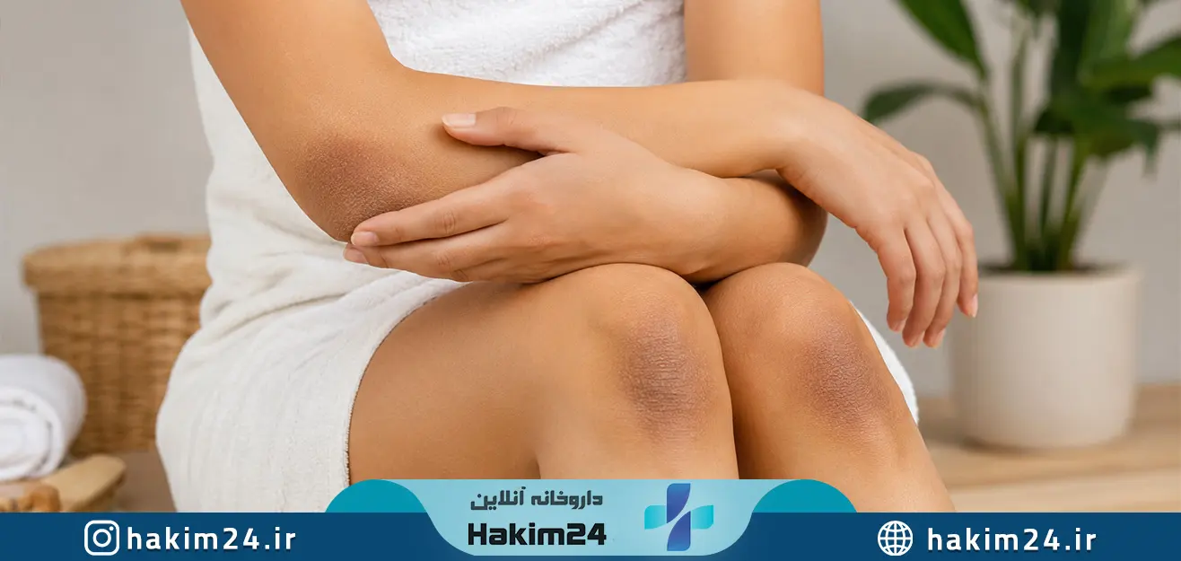 چرا پوست آرنج و زانو تیره می شود؟