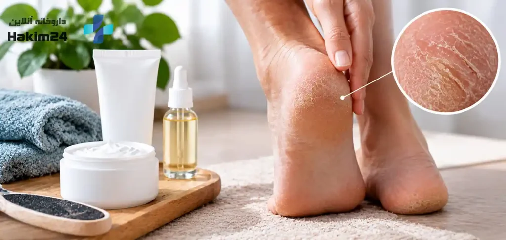 تصویر پاشنه پای خشک و ترک خورده در کنار کرم مرطوب کننده و ابزار مراقبت از پا، نشان دهنده تاثیر خشکی پوست بر ضخیم شدن پوست پا.