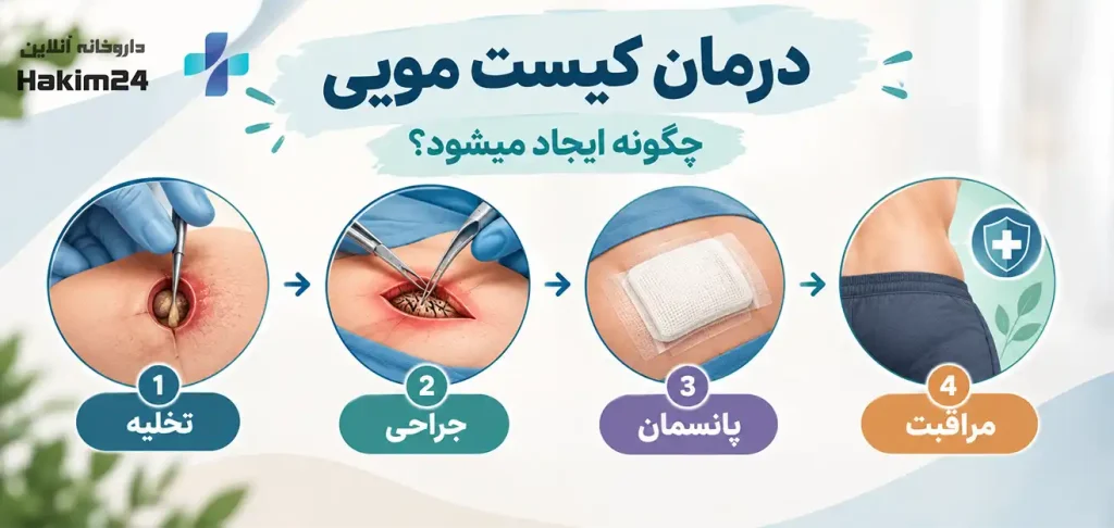 مراحل درمان کیست مویی؛ از تخلیه و جراحی تا مراقبت‌های بعد از درمان»