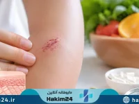 تصویر پوست سالم و روند طبیعی ترمیم یک زخم سطحی که نشان دهنده اهمیت تغذیه و سلامت عمومی بدن در بهبود زخم ها است.