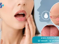 علت خشکی دهان و کاهش ترشح بزاق در بزرگسالان