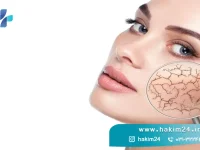 چگونه خشکی پوست را درمان کنیم؟