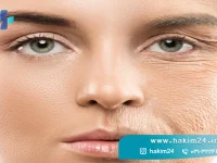 کلاژن سازی پوست