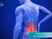 پیشگیری از کمردرد